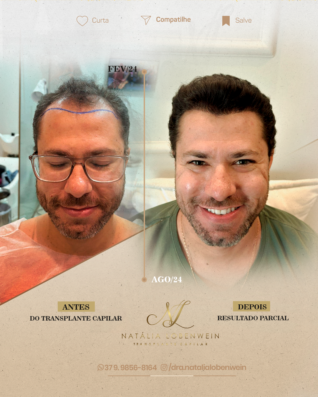 carrossel-resultado-6-meses_01