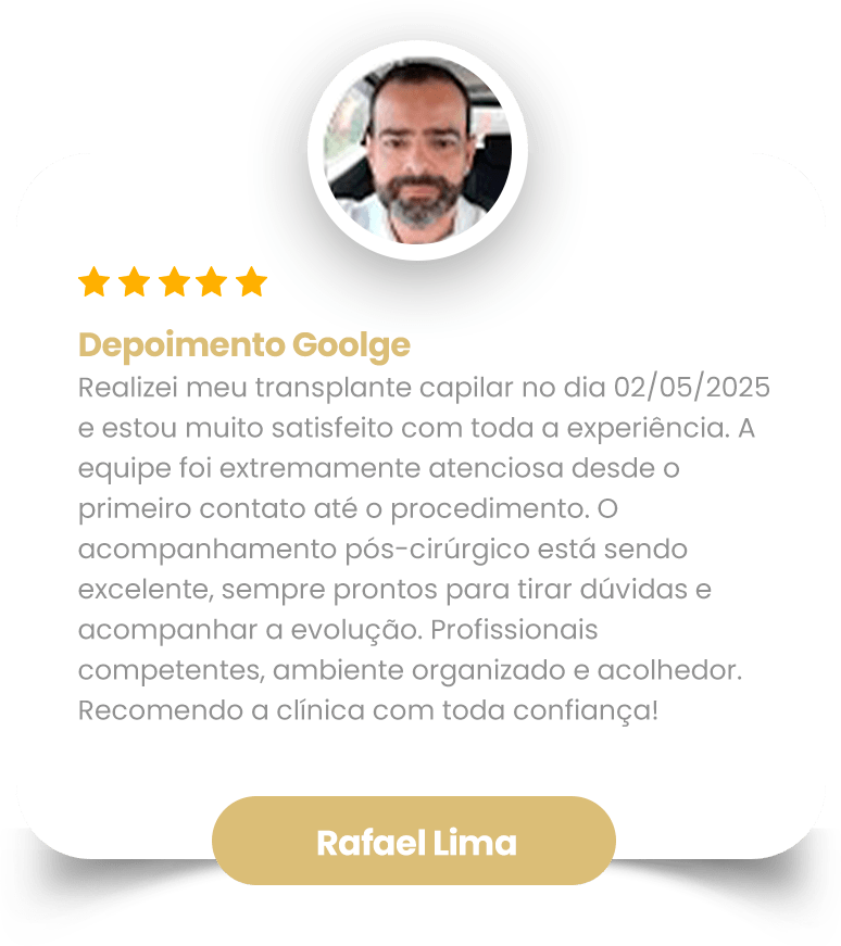 Depoimento transplante capilar 01-min